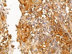 Invitrogen LZK Polyclonal Antibody 100 &mu;L; Unconjugated:Antibodies,