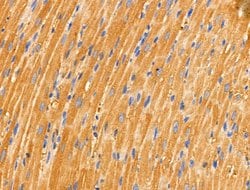 Invitrogen LZK Polyclonal Antibody 100 &mu;L; Unconjugated:Antibodies,