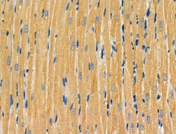 Invitrogen NAA15 Polyclonal Antibody 100 &mu;L | Buy Online | Invitrogen&trade; | Fisher Scientific
