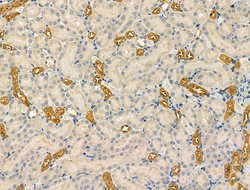 Invitrogen NAA15 Polyclonal Antibody 100 &mu;L | Buy Online | Invitrogen&trade; | Fisher Scientific