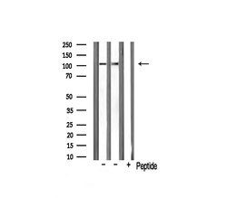 Invitrogen NAA15 Polyclonal Antibody 100 &mu;L | Buy Online | Invitrogen&trade; | Fisher Scientific