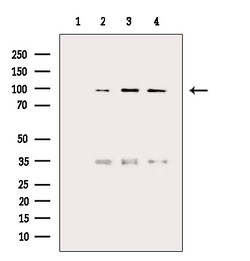 Invitrogen NAA15 Polyclonal Antibody 100 &mu;L | Buy Online | Invitrogen&trade; | Fisher Scientific