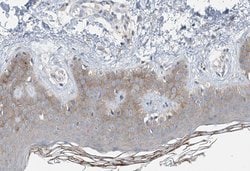 Invitrogen COL14A1 Polyclonal Antibody 100 μL; Unconjugated:Antibodies,
