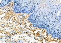 Invitrogen COL14A1 Polyclonal Antibody 100 μL; Unconjugated:Antibodies,