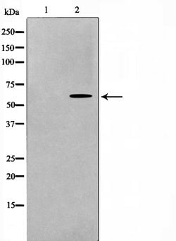 Invitrogen RAD18 Polyclonal Antibody 100 &mu;L; Unconjugated:Antibodies,
