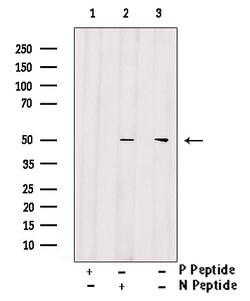 Invitrogen Phospho-IKK gamma (Ser376) Polyclonal Antibody 100 &mu;L | Buy Online | Invitrogen&trade; | Fisher Scientific