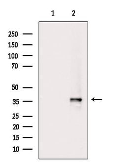Invitrogen Phospho-CDK6 (Tyr13) Polyclonal Antibody 100 &mu;L | Buy Online | Invitrogen&trade; | Fisher Scientific