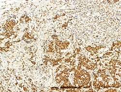 Invitrogen Phospho-FOXO3A (Ser253) Polyclonal Antibody 100 &mu;L; Unconjugated:Antibodies,