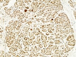 Invitrogen Phospho-FOXO3A (Ser253) Polyclonal Antibody 100 &mu;L; Unconjugated:Antibodies,