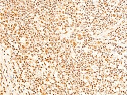 Invitrogen Phospho-FOXO3A (Ser253) Polyclonal Antibody 100 &mu;L; Unconjugated:Antibodies,