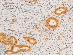Invitrogen Phospho-FOXO3A (Ser253) Polyclonal Antibody 100 &mu;L; Unconjugated:Antibodies,