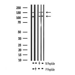 Phospho-IR/IGF1R (Tyr1161) Polyclonal Antibody, Invitrogen 100 &mu;L; Unconjugated:Antibodies,