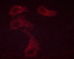 Phospho-Bcl-2 (Thr69) Polyclonal Antibody, Invitrogen 100 &mu;L | Buy Online | Invitrogen | Fisher Scientific