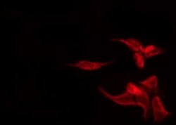 Phospho-Bcl-2 (Thr69) Polyclonal Antibody, Invitrogen 100 &mu;L | Buy Online | Invitrogen | Fisher Scientific