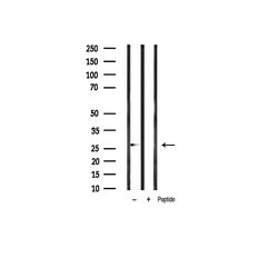 Phospho-Bcl-2 (Thr69) Polyclonal Antibody, Invitrogen 100 &mu;L | Buy Online | Invitrogen | Fisher Scientific