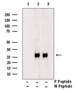 Phospho-Bcl-2 (Thr69) Polyclonal Antibody, Invitrogen 100 &mu;L | Buy Online | Invitrogen | Fisher Scientific