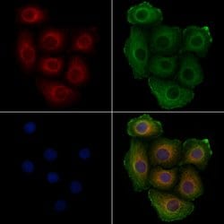 Phospho-BCR (Tyr360) Polyclonal Antibody, Invitrogen 100 &mu;L; Unconjugated:Antibodies,