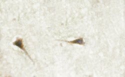 Phospho-BCR (Tyr360) Polyclonal Antibody, Invitrogen 100 &mu;L; Unconjugated:Antibodies,