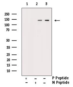Phospho-BCR (Tyr360) Polyclonal Antibody, Invitrogen 100 &mu;L; Unconjugated:Antibodies,