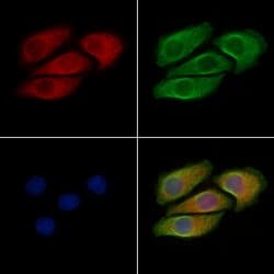 Invitrogen Phospho-B-Raf (Thr599) Polyclonal Antibody 100 &mu;L; Unconjugated:Antibodies,