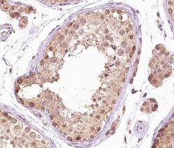 Invitrogen Phospho-B-Raf (Thr599) Polyclonal Antibody 100 &mu;L; Unconjugated:Antibodies,