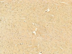 Invitrogen Phospho-PI3K p85/p55 (Tyr467, Tyr199) Polyclonal Antibody 100