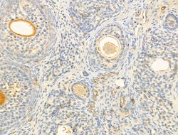Invitrogen Phospho-PI3K p85/p55 (Tyr467, Tyr199) Polyclonal Antibody 100