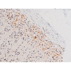 Invitrogen Phospho-JNK1/JNK2/JNK3 (Thr183, Tyr185) Polyclonal Antibody