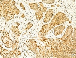 Invitrogen Phospho-JNK1/JNK2/JNK3 (Thr183, Tyr185) Polyclonal Antibody