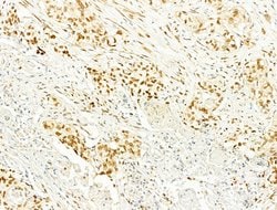 Invitrogen Phospho-JNK1/JNK2/JNK3 (Thr183, Tyr185) Polyclonal Antibody