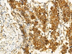 Invitrogen Phospho-JNK1/JNK2/JNK3 (Thr183, Tyr185) Polyclonal Antibody
