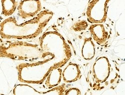 Invitrogen Phospho-JNK1/JNK2/JNK3 (Thr183, Tyr185) Polyclonal Antibody