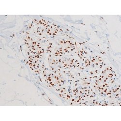 Invitrogen Phospho-JNK1/JNK2/JNK3 (Thr183, Tyr185) Polyclonal Antibody