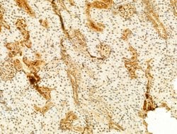 Invitrogen Phospho-JNK1/JNK2/JNK3 (Thr183, Tyr185) Polyclonal Antibody