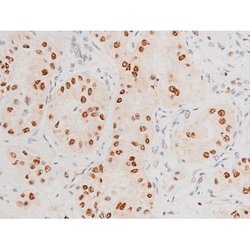 Invitrogen Phospho-JNK1/JNK2/JNK3 (Thr183, Tyr185) Polyclonal Antibody