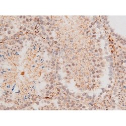 Invitrogen Phospho-JNK1/JNK2/JNK3 (Thr183, Tyr185) Polyclonal Antibody