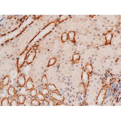 Invitrogen Phospho-JNK1/JNK2/JNK3 (Thr183, Tyr185) Polyclonal Antibody