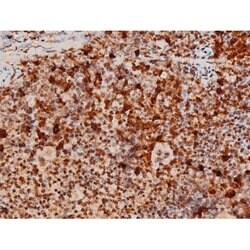 Invitrogen Phospho-JNK1/JNK2/JNK3 (Thr183, Tyr185) Polyclonal Antibody
