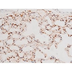 Invitrogen Phospho-JNK1/JNK2/JNK3 (Thr183, Tyr185) Polyclonal Antibody