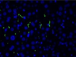 Invitrogen Phospho-LIMK1 (Thr508) Polyclonal Antibody 100 &mu;L | Buy Online | Invitrogen&trade; | Fisher Scientific