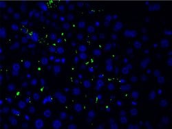 Invitrogen Phospho-LIMK1 (Thr508) Polyclonal Antibody 100 &mu;L | Buy Online | Invitrogen&trade; | Fisher Scientific