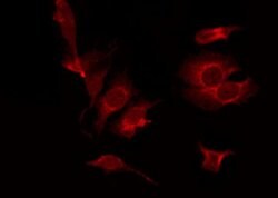 Invitrogen Phospho-LIMK1 (Thr508) Polyclonal Antibody 100 &mu;L | Buy Online | Invitrogen&trade; | Fisher Scientific