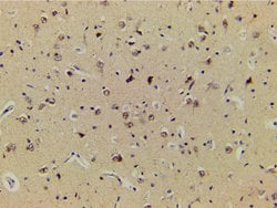 Invitrogen Phospho-LIMK1 (Thr508) Polyclonal Antibody 100 &mu;L | Buy Online | Invitrogen&trade; | Fisher Scientific