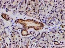 Invitrogen Phospho-LIMK1 (Thr508) Polyclonal Antibody 100 &mu;L | Buy Online | Invitrogen&trade; | Fisher Scientific