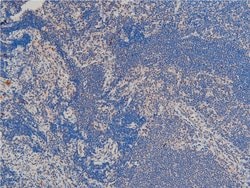 Invitrogen Phospho-LIMK1 (Thr508) Polyclonal Antibody 100 &mu;L | Buy Online | Invitrogen&trade; | Fisher Scientific