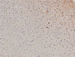 Invitrogen Phospho-LIMK1 (Thr508) Polyclonal Antibody 100 &mu;L | Buy Online | Invitrogen&trade; | Fisher Scientific