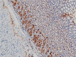 Invitrogen Phospho-LIMK1 (Thr508) Polyclonal Antibody 100 &mu;L | Buy Online | Invitrogen&trade; | Fisher Scientific