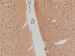 Invitrogen Phospho-LIMK1 (Thr508) Polyclonal Antibody 100 &mu;L | Buy Online | Invitrogen&trade; | Fisher Scientific