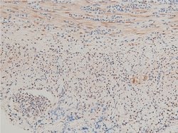 Invitrogen Phospho-LIMK1 (Thr508) Polyclonal Antibody 100 &mu;L | Buy Online | Invitrogen&trade; | Fisher Scientific