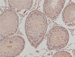 Invitrogen Phospho-LIMK1 (Thr508) Polyclonal Antibody 100 &mu;L | Buy Online | Invitrogen&trade; | Fisher Scientific